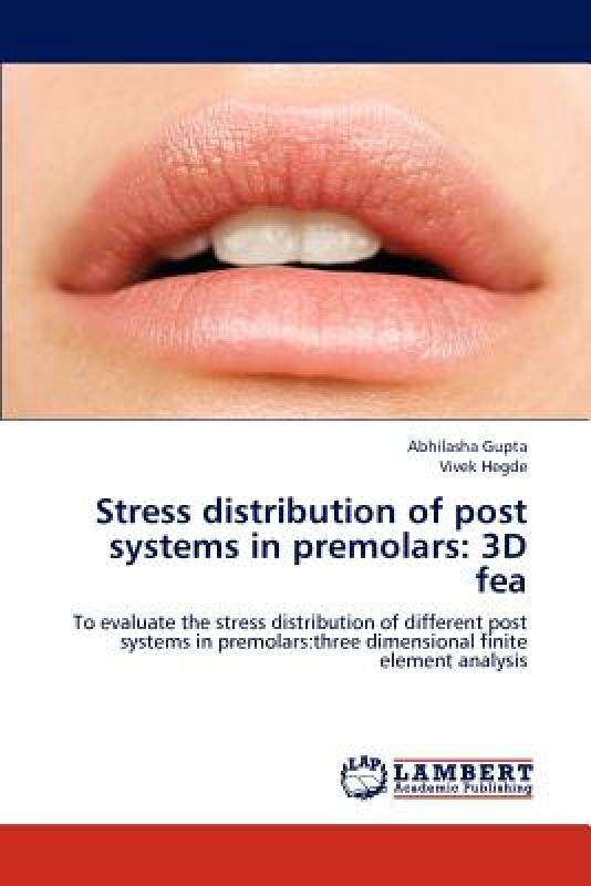【预售】Stress Distribution of Post Systems in Premolars: 3D