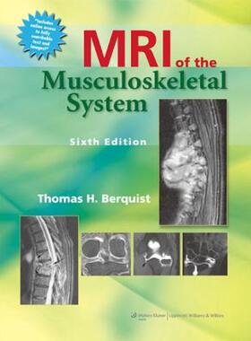 【预售】MRI of the Musculoskeletal System with Access Code