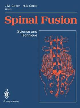 【预售】Spinal Fusion: Science and Technique
