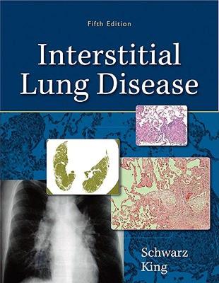 【预售】Interstitial Lung Disease