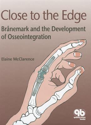 【预售】Close to the Edge: Branemark and the Development of