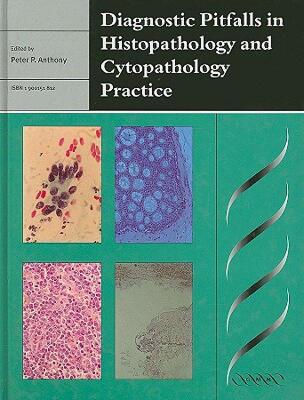 【预售】Diagnostic Pitfalls in Histopathology and