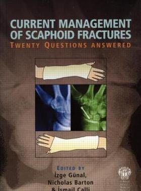 【预售】Current Management of Scaphoid Fractures