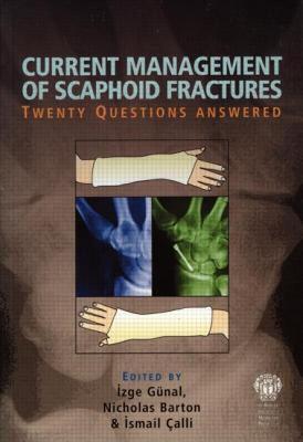 【预售】Current Management of Scaphoid Fractures