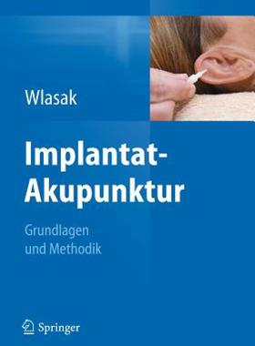 【预售】Implantat-Akupunktur: Grundlagen Und Methodik