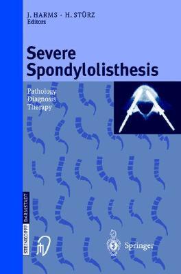 【预售】Severe Spondylolisthesis: Pathology - Diagnosis -