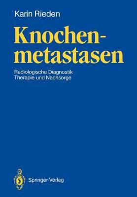【预售】Knochenmetastasen: Radiologische Diagnostik