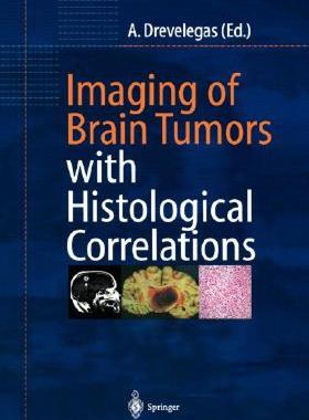 【预售】Imaging of Brain Tumors with Histological
