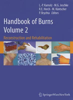 【预售】Handbook of Burns, Volume 2: Reconstruction and