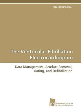 【预售】The Ventricular Fibrillation Electrocardiogram