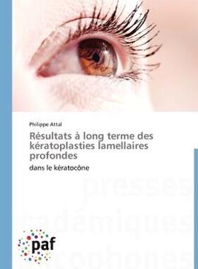 【预售】R Sultats Long Terme Des K Ratoplasties Lamellaires