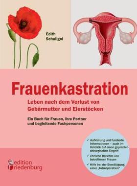 【预售】Frauenkastration - Leben Nach Dem Verlust Von