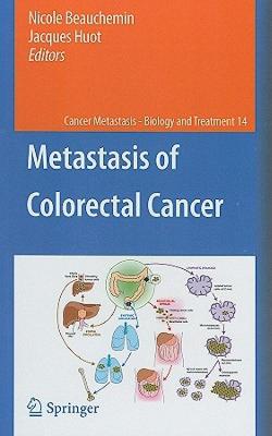 【预售】Metastasis of Colorectal Cancer