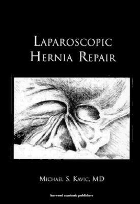 【预售】Laparoscopic Hernia Repair