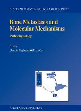 【预售】Bone Metastasis and Molecular Mechanisms: