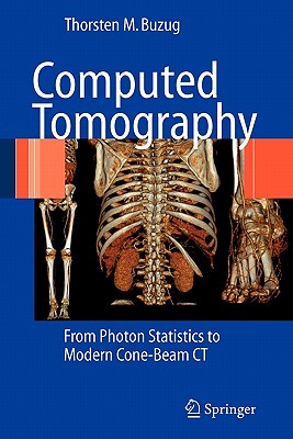 【预售】Computed Tomography: From Photon Statistics to