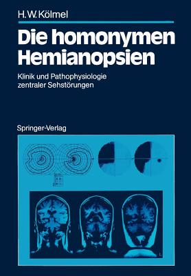 【预售】Die Homonymen Hemianopsien: Klinik Und