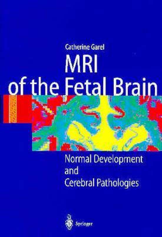 【预售】MRI of the Fetal Brain: Normal Development and