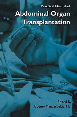【预售】Practical Manual of Abdominal Organ Transplantation