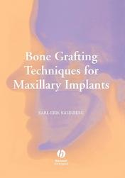 【预售】Bone Grafting Techniques For Maxillary Implants