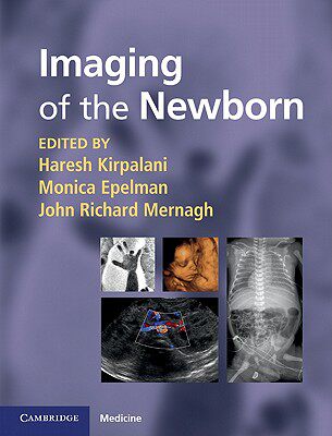【预售】Imaging of the Newborn