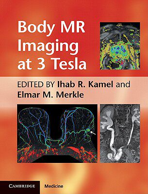 【预售】Body MR Imaging at 3.0 Tesla