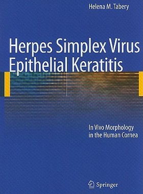 【预售】Herpes Simplex Virus Epithelial Keratitis: In Vivo