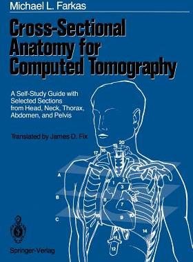 【预售】Cross-Sectional Anatomy for Computed Tomography: A
