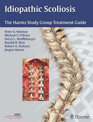 【预售】Idiopathic Scoliosis: The Harms Study Group