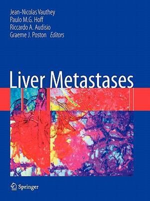 【预售】Liver Metastases