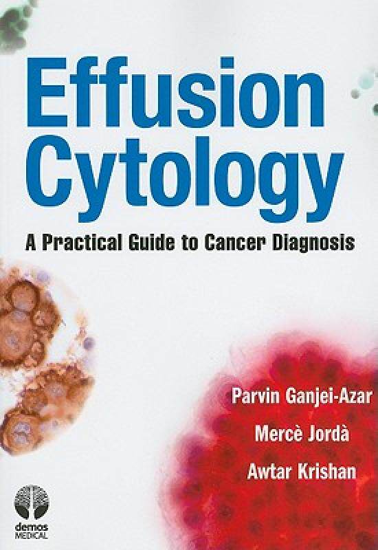 【预售】Effusion Cytology: A Practical Guide to Cancer