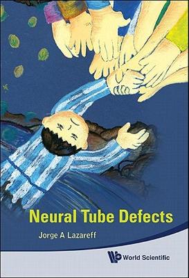 【预售】Neural Tube Defects