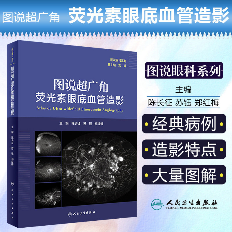 正版 图说超广角荧光素眼底血管造影图说眼科系列陈长征苏钰郑红梅主编超广角眼底自发荧光 人民卫生出版社9787117314510