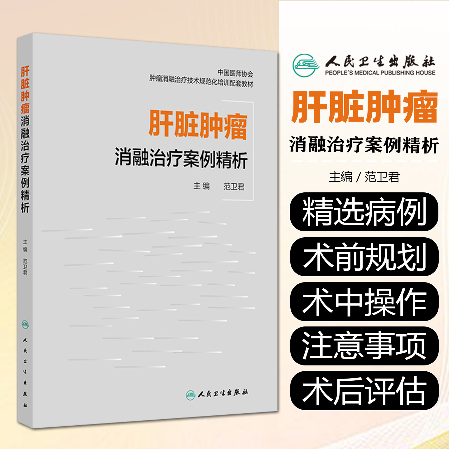 肝脏肿瘤消融治疗案例精析范卫君人民卫生出版社9787117380683
