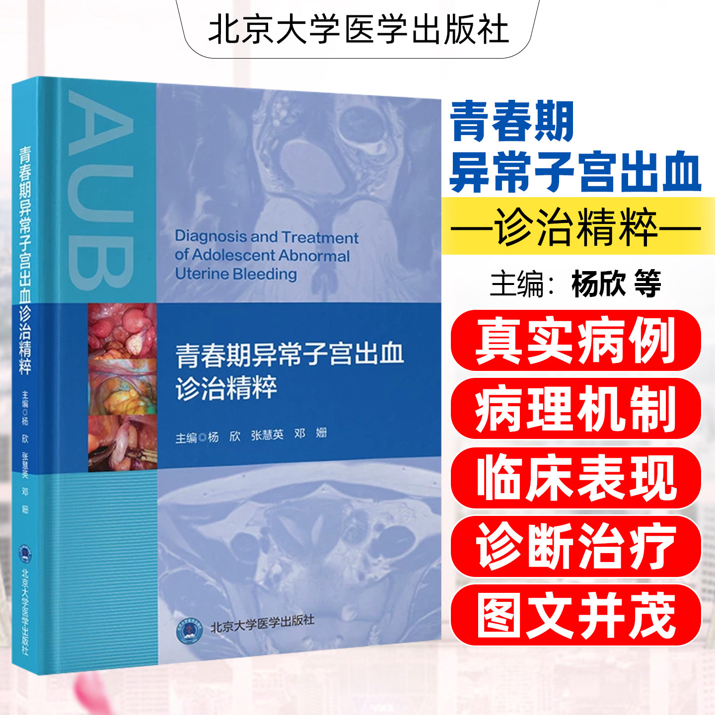 青春期异常子宫出血诊治精粹 杨欣 张慧英 邓姗 主编 详细讲解青春期异常子宫出血的生理及病理机制等内容 北京大学医学出版社