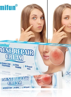 sumifun 速卖通跨境 痤疮护理膏 疤痕护理乳膏 皮肤外用 K10063