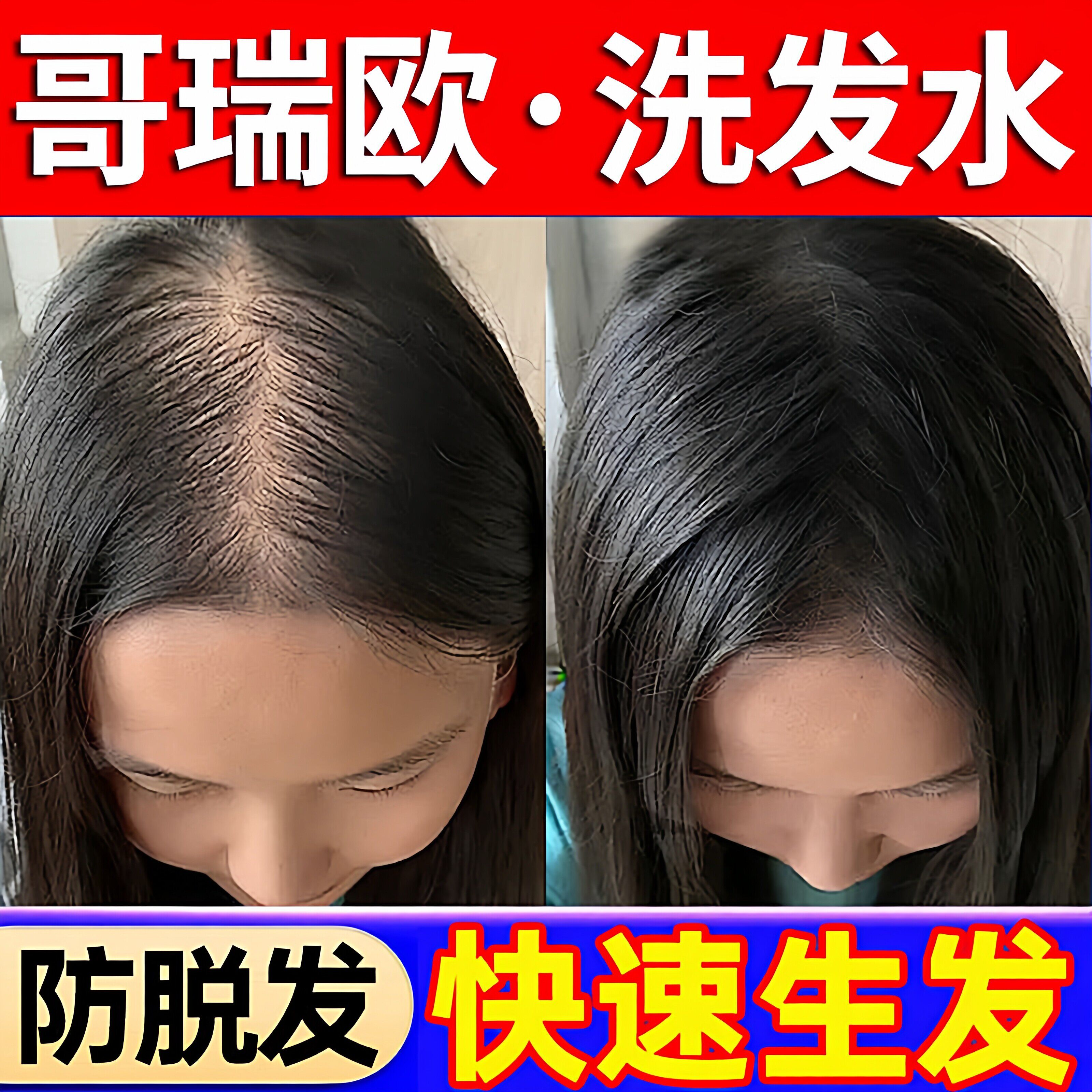 哥瑞欧洗发水防脱发生发控油蓬松侧柏叶哥瑞欧正品官方店