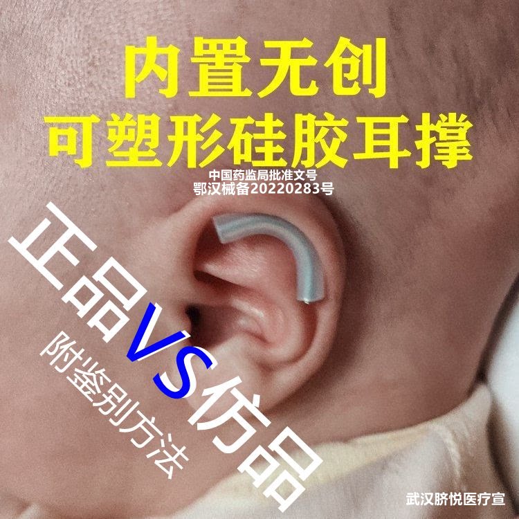 婴儿畸形耳朵矫正器贴