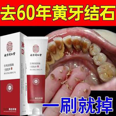 美白牙膏牙结石去除器去黄去口臭漱口水溶解速效烟渍污垢洗白神器