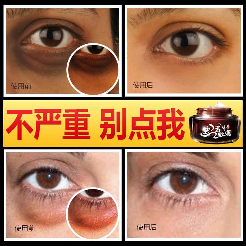 去眼袋神器祛除黑眼圈蛇毒眼霜去細紋緊致不抗皺衰老脂肪粒去除膏