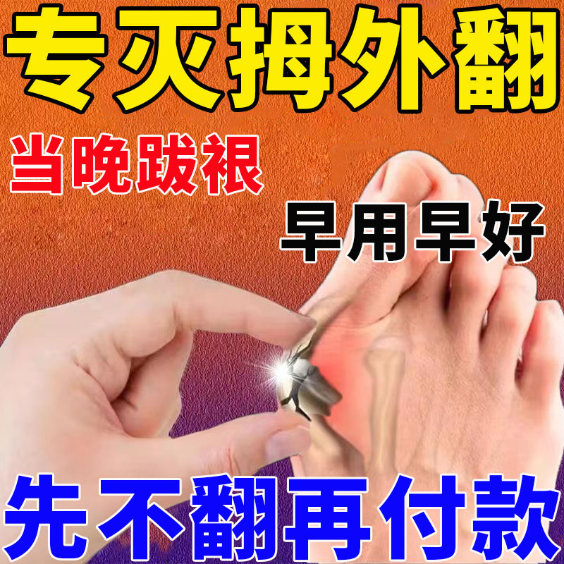 治疗大拇指外翻贴脚趾矫正贴