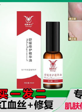 去红血丝高原红修复精华液脸泛红