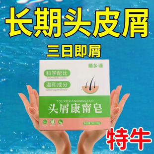 强效去屑康去头屑止痒洗发水大块头皮屑脂溢性毛囊除螨控油洗发皂
