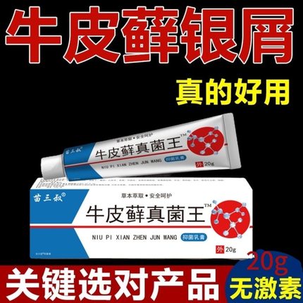 股藓大腿内侧根皮肤瘙痒真菌感染牛皮癣银屑药体股癣去湿疹止痒膏