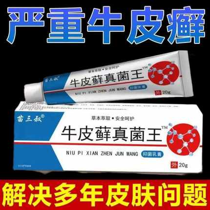 股藓大腿内侧根皮肤瘙痒真菌感染牛皮癣银屑药体股癣去湿疹止痒膏