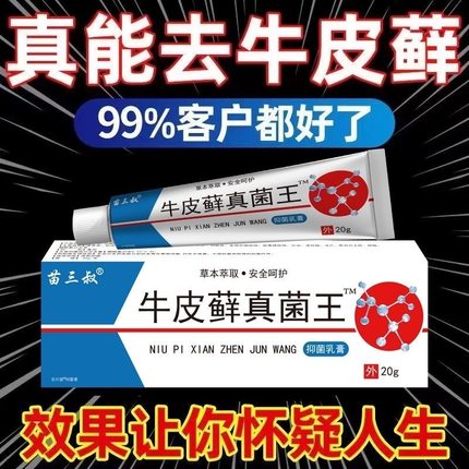 股藓大腿内侧根皮肤瘙痒真菌感染牛皮癣银屑药体股癣去湿疹止痒膏