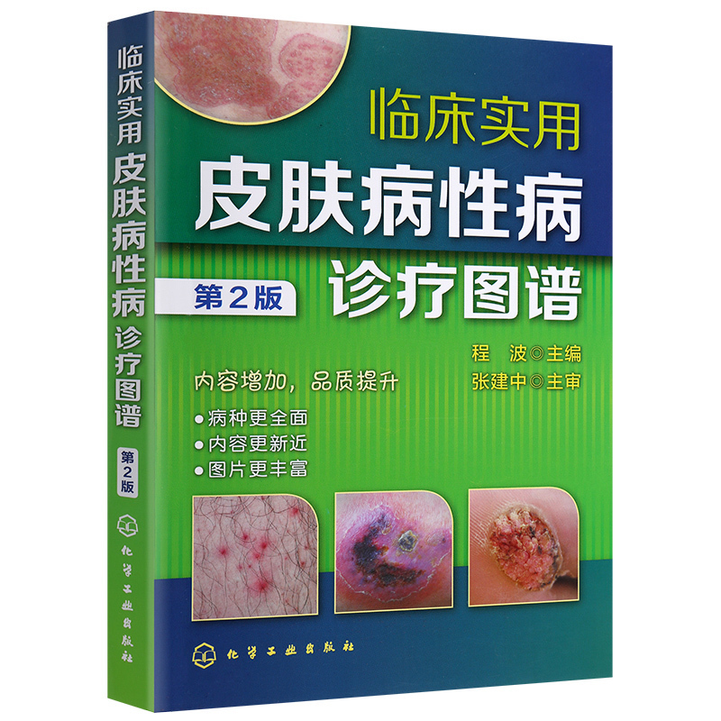 实用胰腺疾病超声诊断学