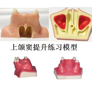 牙科模型上颌窦提升练习缺失牙带窦种植模型仿真牙齿模型练习模型