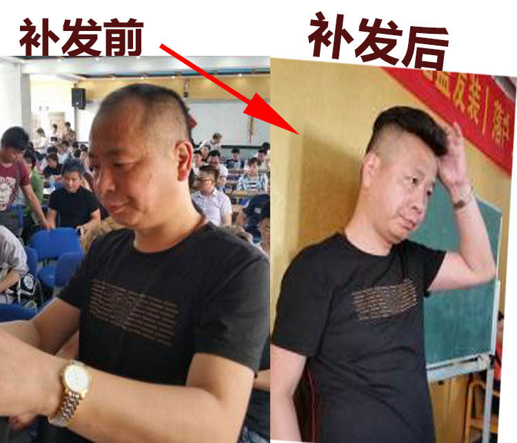 Extension cheveux - Ref 218127 Image 4