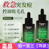颜可纯三酸复合精华液清爽祛痘改善肌肤粗糙补水滋润细腻嫩滑护肤